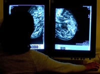 Hundreds of 'missing' cancer diagnoses in Gloucestershire in 2020 – as fewer found at early stage